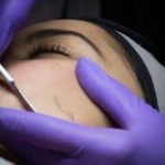 Dermaplaning Clarence, Williamsville, Buffalo, Lancaster New York